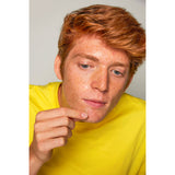 Acnemy ZITPROOF® SPOT Individual Hydrocolloid Patches. Hüdrokolloidplaastrid vistrikele 36 plaastrit